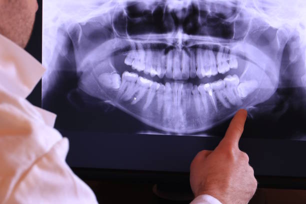 Best Emergency Gum Treatment in Iowa City, IA